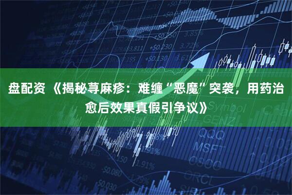 盘配资 《揭秘荨麻疹：难缠“恶魔”突袭，用药治愈后效果真假引争议》